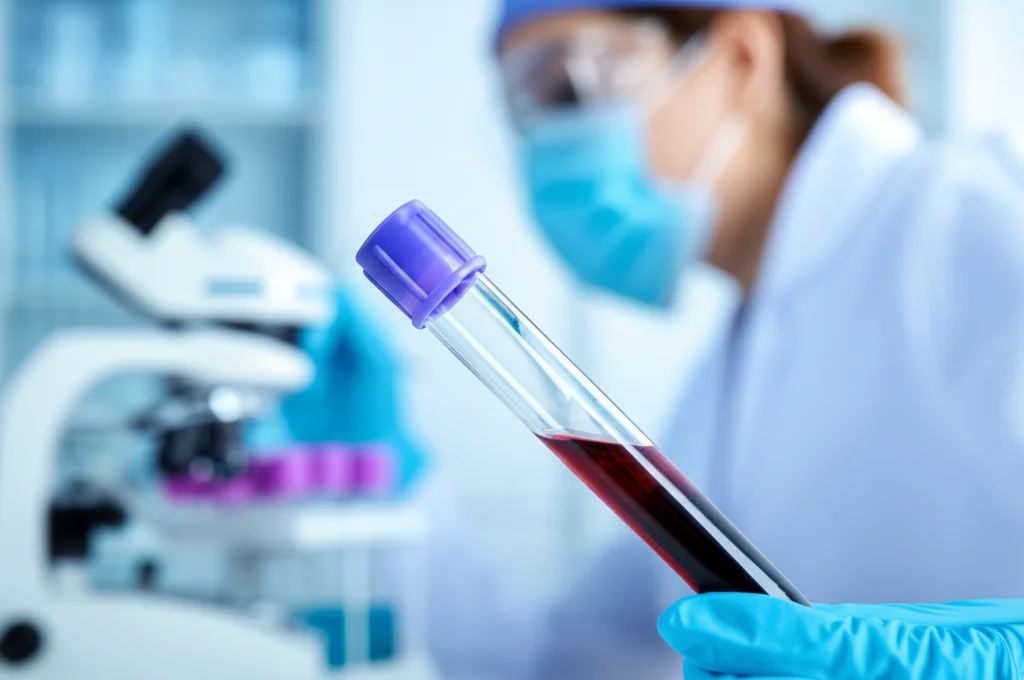 Primo piano macro di una provetta di sangue con sfondo sfocato di un laboratorio medico, obiettivo macro 100mm, alta definizione, illuminazione controllata precisa, che simboleggia l'analisi dei parametri clinici e ormonali.