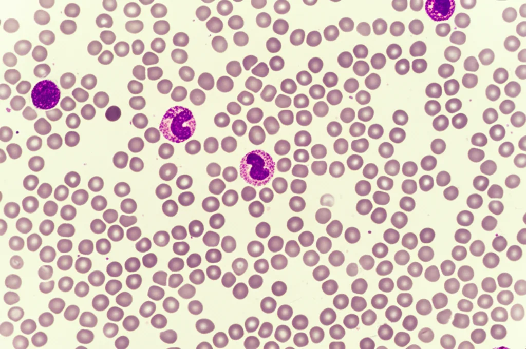 Vista al microscopio di cellule del sangue umano, con eosinofili evidenziati in rosa acceso, obiettivo macro 100mm, alta definizione, messa a fuoco precisa, illuminazione controllata da laboratorio.