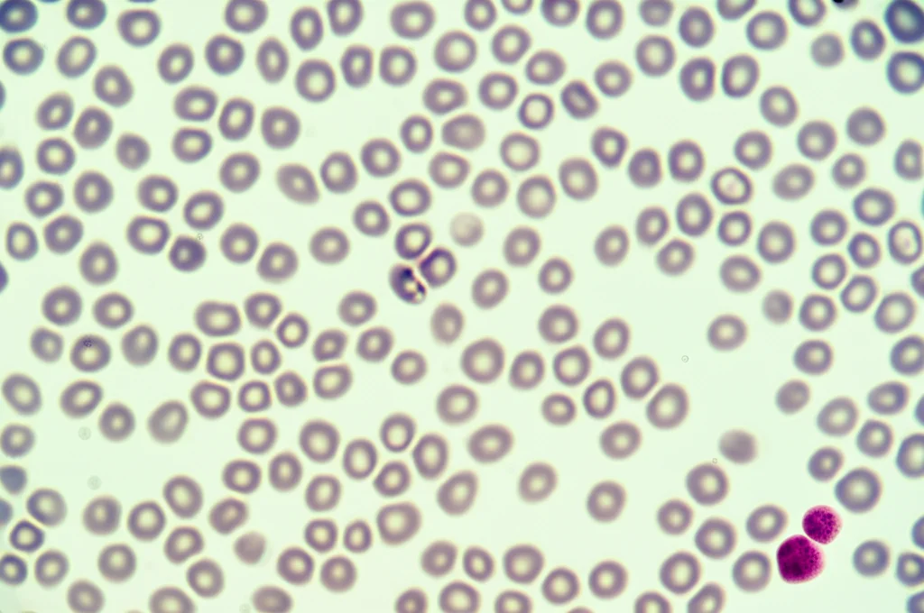 Immagine macro ad alta definizione di una provetta di siero sanguigno in un laboratorio di ricerca, con luce controllata che evidenzia le cellule del sangue, simboleggiando l'analisi della mieloperossidasi. Obiettivo macro 100mm, alta precisione di messa a fuoco.