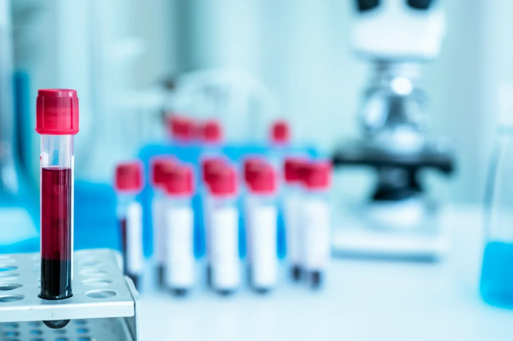 Primo piano di una provetta di sangue in un laboratorio di analisi mediche, con sfondo sfocato di attrezzature scientifiche. Macro lens, 100mm, high detail, precise focusing, controlled lighting.