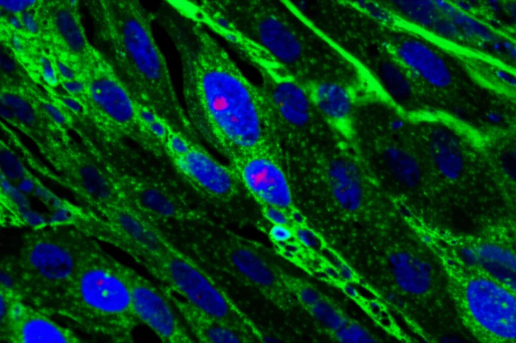 Micrografia di tessuto epatico umano che mostra segni iniziali di fibrosi e stress ossidativo, con alcune cellule evidenziate in fluorescenza, lente macro 60mm, alta definizione, illuminazione da laboratorio controllata, per visualizzare il danno epatico a livello tissutale.