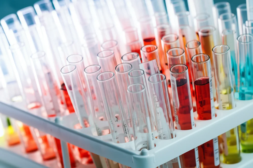 Immagine macro, obiettivo 100mm, di provette colorate in un rack da laboratorio, con messa a fuoco precisa e illuminazione controllata, a simboleggiare l'analisi dei costi e dei volumi degli esami.