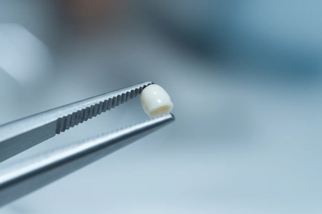 Primo piano fotorealistico di un impianto dentale in zirconio (YSZ) bianco brillante, perfettamente liscio e uniformemente rivestito, tenuto delicatamente con pinzette chirurgiche metalliche in un ambiente sterile e luminoso, simile a uno studio dentistico. Obiettivo macro 100mm, alta definizione dei dettagli superficiali, messa a fuoco selettiva sull'impianto, bokeh dello sfondo clinico. Riflessi morbidi sulla superficie ceramica.