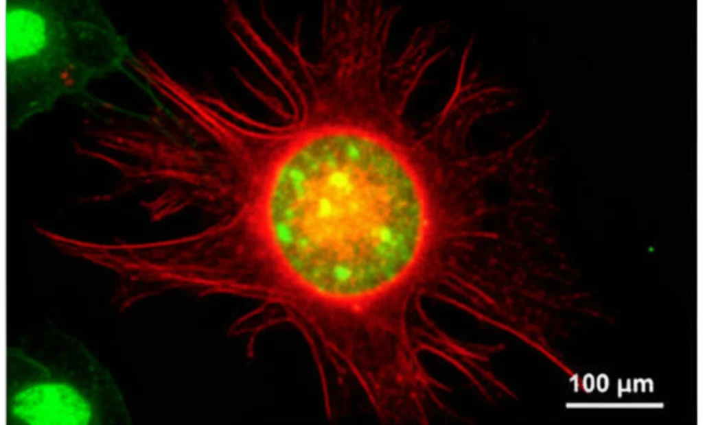 Microscopia a fluorescenza ad alta risoluzione che mostra la fusione tra una cellula di glioma (verde brillante, GFP) e una cellula staminale mesenchimale associata al glioma (rosso brillante, mCherry) all'interno di un tessuto cerebrale stilizzato, evidenziando la formazione di una cellula ibrida giallo/arancione. Illuminazione controllata, obiettivo macro 100mm, alta definizione, focus preciso sulla cellula ibrida.