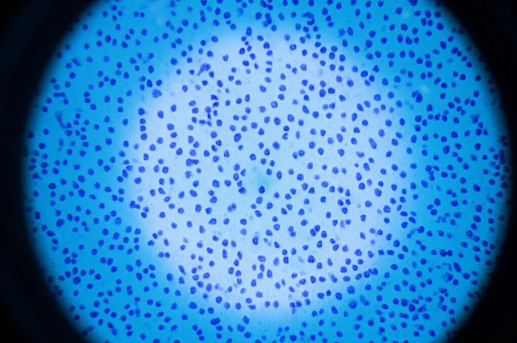 Microarray tissutale (TMA) con decine di piccoli campioni cilindrici di tessuto tumorale incorporati in un blocchetto di paraffina, visto sotto un microscopio da laboratorio, illuminazione precisa, obiettivo macro 105mm, messa a fuoco selettiva, alta definizione.