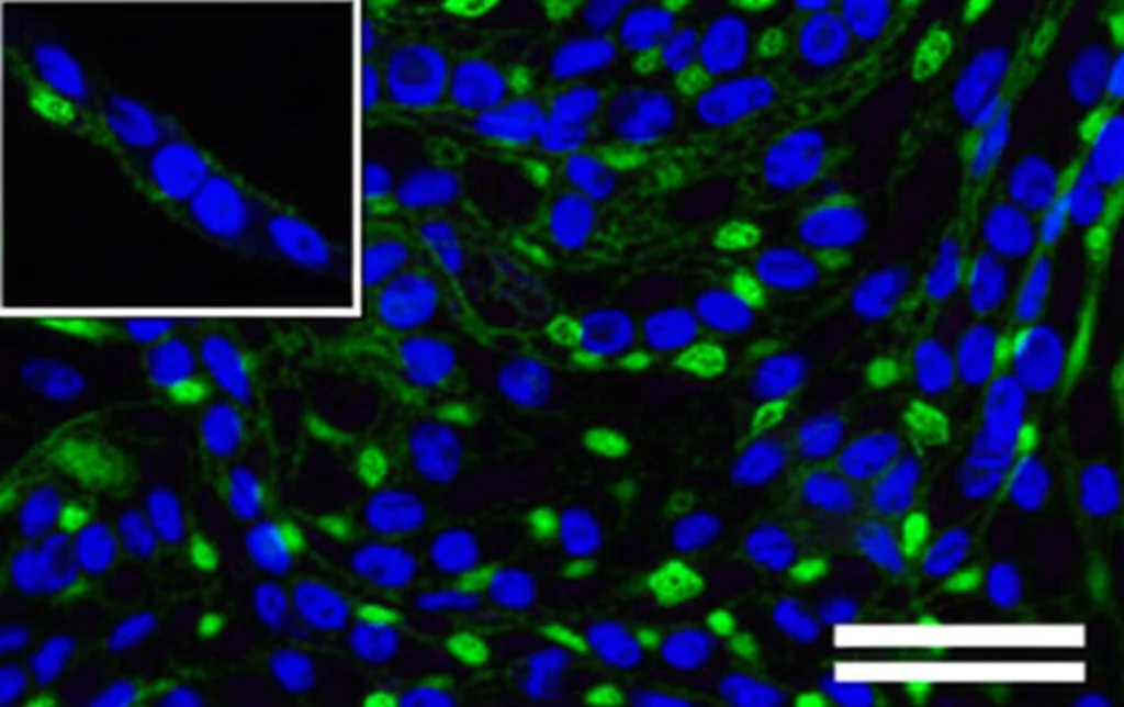 Micrografia a immunofluorescenza di tessuto cutaneo che mostra adipociti maturi (FABP4, verde) tra le fibre del derma; alcuni nuclei cellulari (DAPI, blu) sono visibili. Illuminazione specifica per fluorescenza, alta magnificazione, dettagli cellulari nitidi.