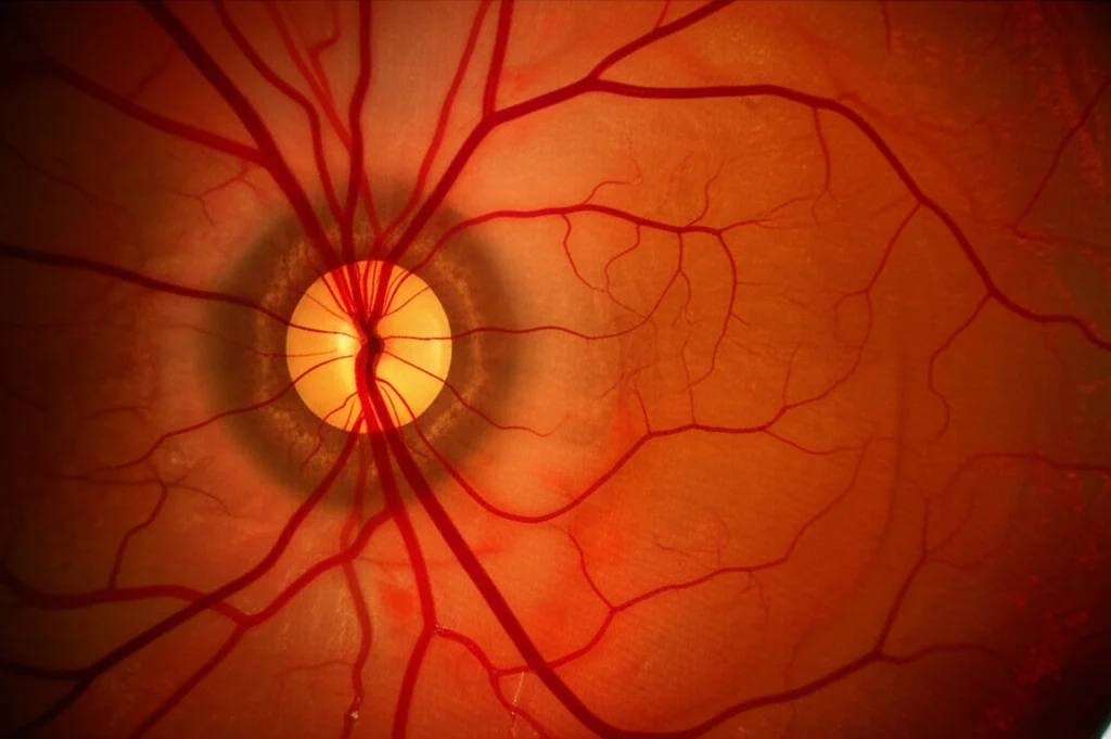 Immagine macro ad altissima definizione dell'interno di un occhio umano, focalizzata sugli strati della retina e della coroide sottostante. Illuminazione controllata per evidenziare la vascolarizzazione coroideale. Obiettivo macro 100mm, alta precisione di messa a fuoco.