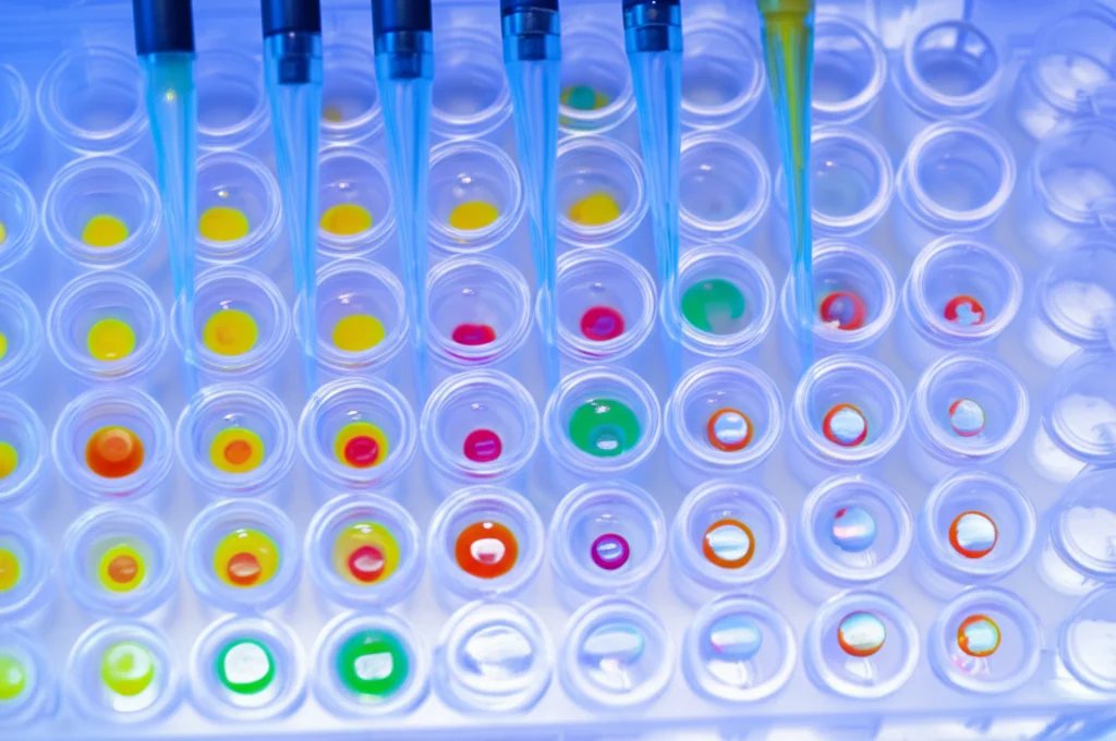 Immagine di piastre multi-pozzetto in un laboratorio di ricerca, con pipette e liquidi colorati, rappresentante lo screening di inibitori di chinasi su linee cellulari di cancro ovarico. Illuminazione da laboratorio controllata, lente macro 60mm per dettaglio sui pozzetti, focus selettivo.