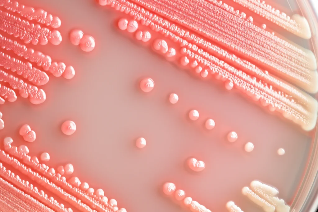 Immagine fotorealistica di colonie batteriche rosa di Methylobacterium che crescono accanto a colonie bianche di Xylella fastidiosa su una piastra di Petri in laboratorio, vista dall'alto, obiettivo macro 60mm, messa a fuoco precisa sui dettagli delle colonie, illuminazione da laboratorio.