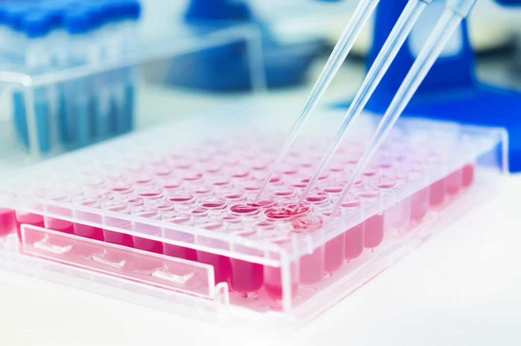 Immagine di laboratorio focalizzata su piastre multi-pozzetto contenenti campioni di sangue o cellule, con pipette e strumentazione scientifica sullo sfondo. Macro lens, 60mm, high detail, precise focusing, illuminazione chiara da laboratorio, suggerendo analisi di metaboliti e fattori infiammatori.