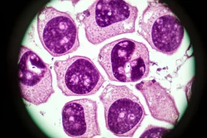 Immagine macro ad alta definizione di cellule epatiche al microscopio, alcune delle quali mostrano segni di carcinoma epatocellulare (HCC), illuminazione da laboratorio controllata, lente macro 105mm, messa a fuoco precisa sui dettagli cellulari.