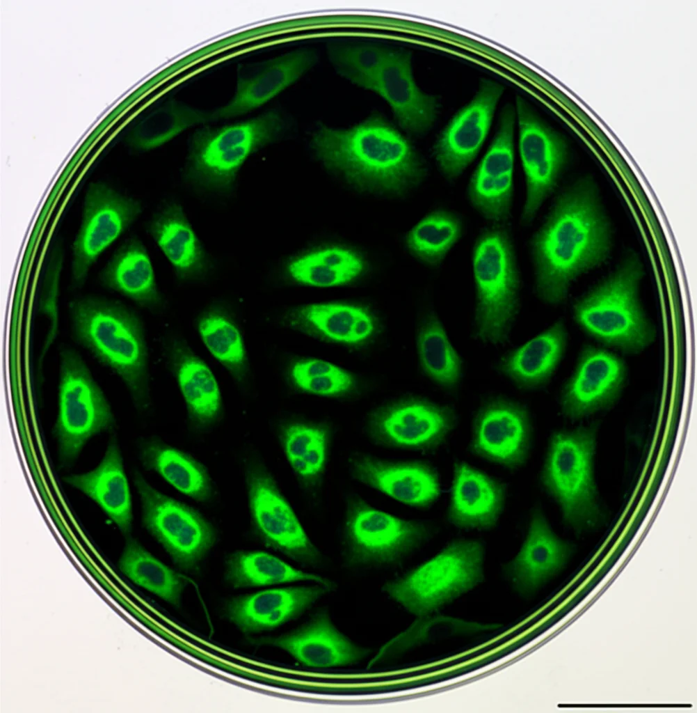 Immagine macro ad alta definizione di una piastra di Petri con cellule HEK293 in coltura, illuminazione controllata per evidenziare i dettagli cellulari, lente macro 100mm, focus preciso sulla fluorescenza verde indicante l'espressione proteica SMN potenziata dalla versione coSMN1 rispetto alla versione normale.