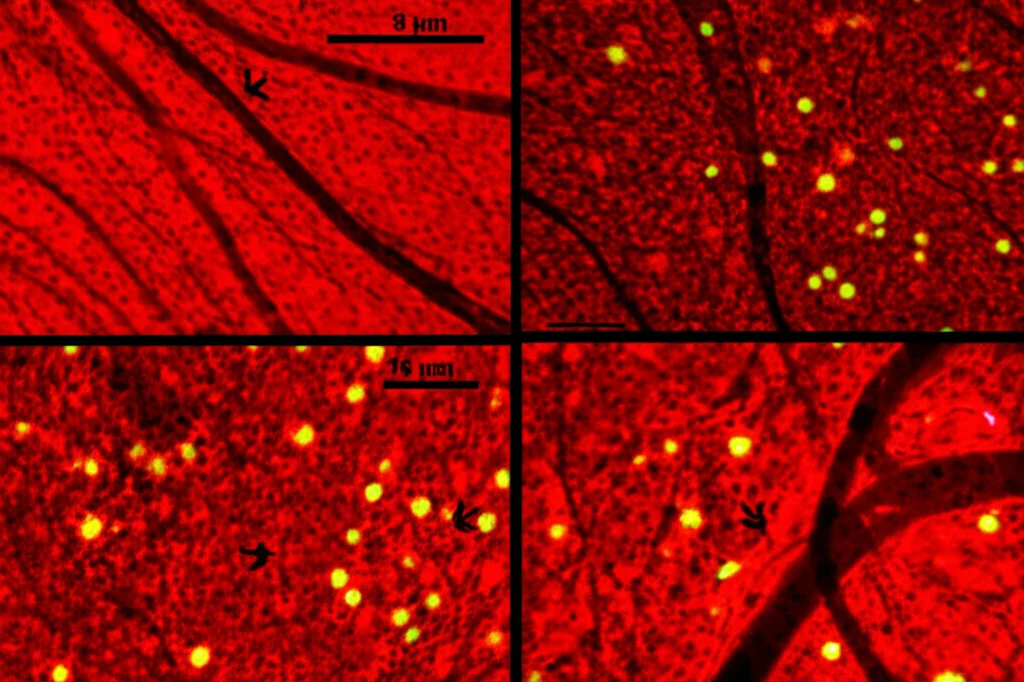 Immagine macro ad alta definizione di neuroni danneggiati e vasi sanguigni cerebrali con segni di ridotta compliance, illuminazione controllata e precisa focalizzazione, per illustrare i cambiamenti microvascolari nella sclerosi multipla.