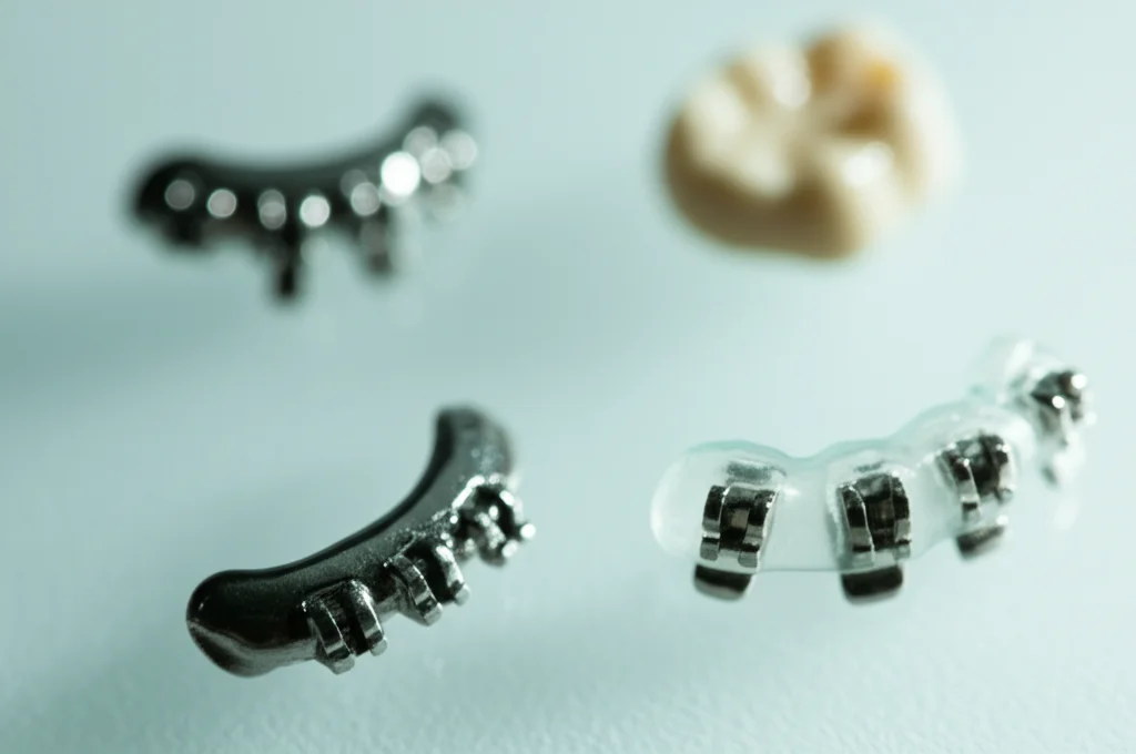 Primo piano macro di tre diversi tipi di bracket ortodontici - uno metallico lucido, uno ceramico bianco e uno autolegante complesso - disposti su una superficie sterile da laboratorio, illuminazione laterale controllata per evidenziare texture e dettagli, obiettivo macro 90mm, alta definizione.