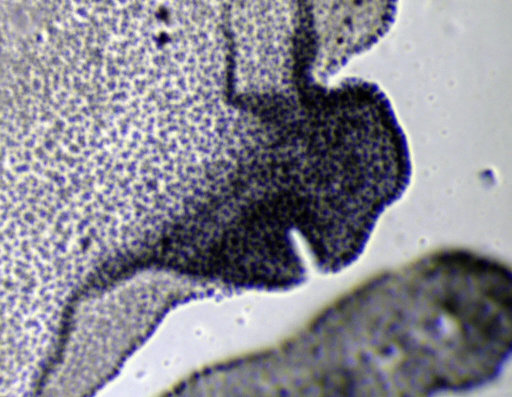 Fotomicrografia di un espianto polmonare embrionale di topo trattato con FGF10-STAB, che mostra una dilatazione anomala delle gemme epiteliali e una ridotta ramificazione. Dettaglio elevato, illuminazione da microscopia confocale, focale macro 80mm.