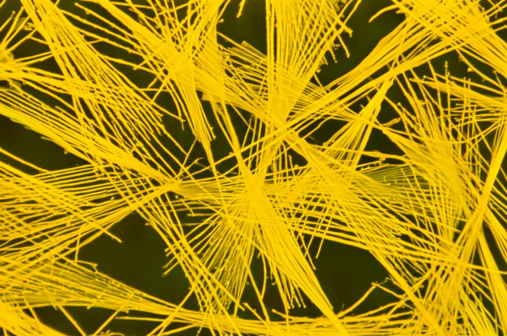 Macro fotografia di cellule staminali mesenchimali umane (hMSCs) in una piastra di coltura, illuminate con luce controllata da laboratorio. Alcune cellule mostrano morfologia alterata indicativa di differenziazione osteogenica, con depositi minerali visibili come piccoli aggregati brillanti. Obiettivo macro 100mm, alta definizione, messa a fuoco precisa.