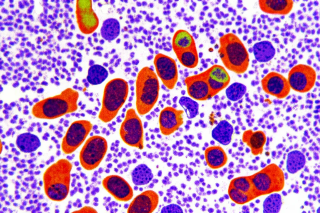 Visualizzazione artistica ma realistica di cellule tumorali polmonari al microscopio, con alcune cellule che mostrano segni di danno al DNA o divisione anomala, illuminazione controllata, alto dettaglio.