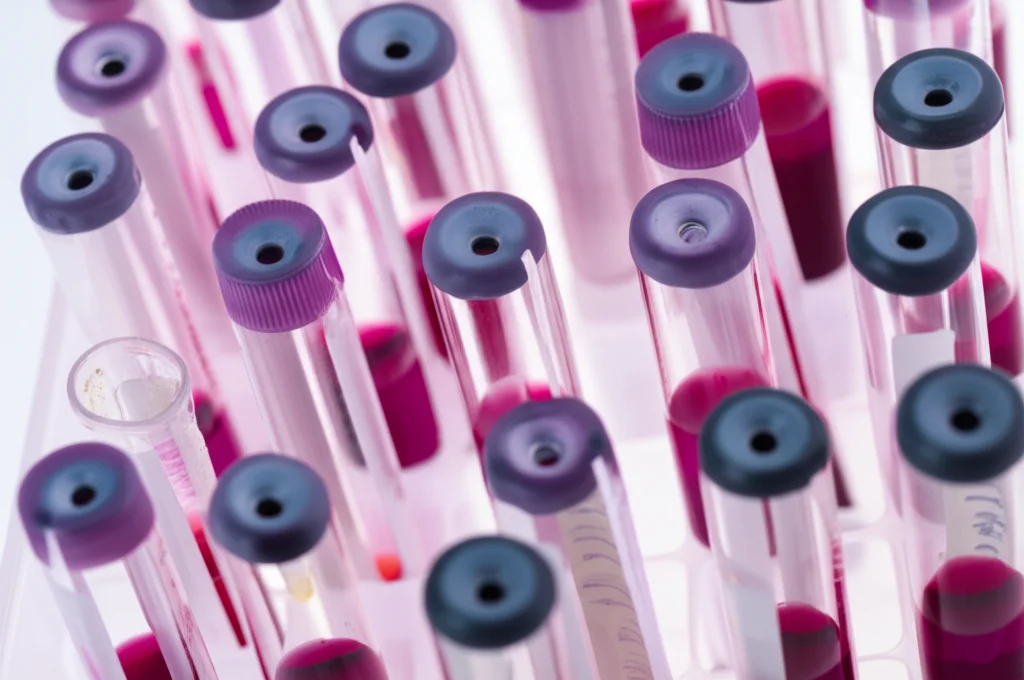 Fotografia macro di provette contenenti campioni di sangue per l'analisi dell'espressione genica dell'Interleuchina 8, illuminazione controllata da laboratorio, alta definizione, obiettivo macro 100mm, messa a fuoco precisa.