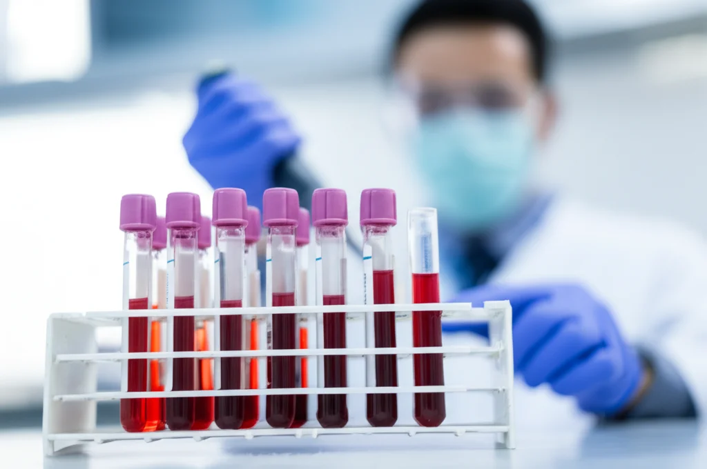 Primo piano macro di diverse provette di siero sanguigno in un rack da laboratorio, con un tecnico sfocato sullo sfondo che utilizza una pipetta. Illuminazione controllata da laboratorio, obiettivo macro 100mm, alta definizione dei dettagli sulle etichette e sul siero.