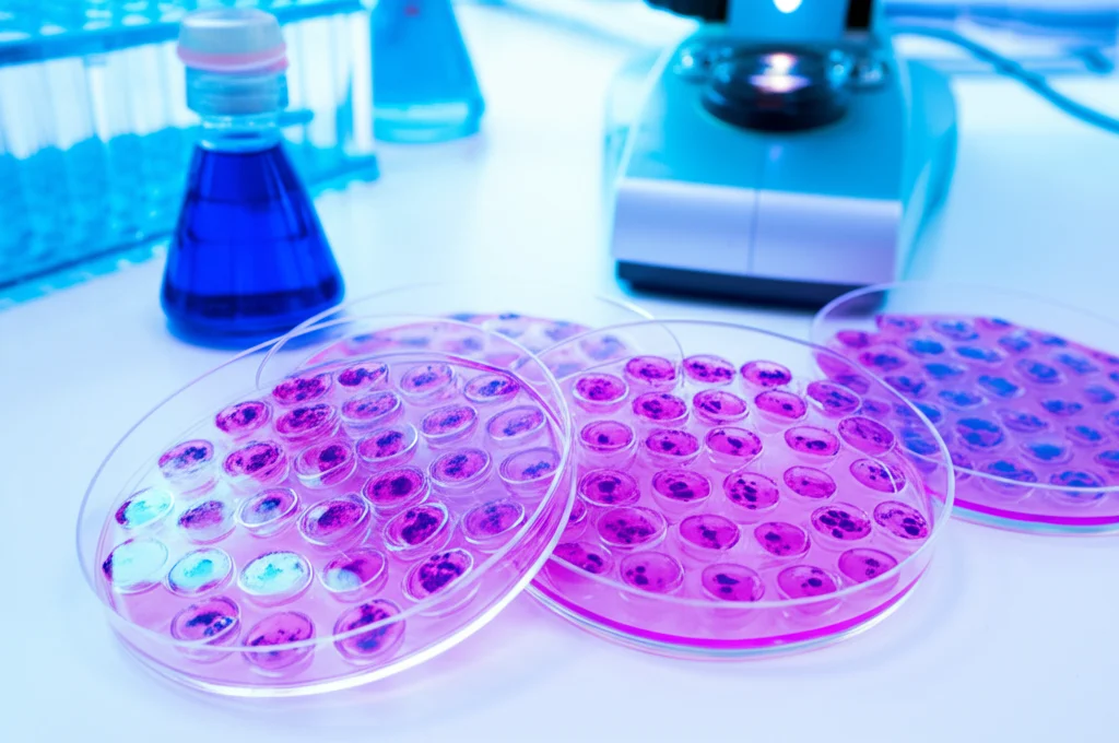 Immagine fotorealistica di piastre di coltura cellulare in un laboratorio di ricerca. In primo piano, una piastra multi-pozzetto con cellule tumorali prostatiche colorate con cristalvioletto, mostrando differenze di densità cellulare tra i pozzetti trattati con diversi mezzi condizionati. Sullo sfondo, un microscopio e altre attrezzature da laboratorio. Illuminazione controllata da laboratorio, lente macro 60mm, alta definizione.