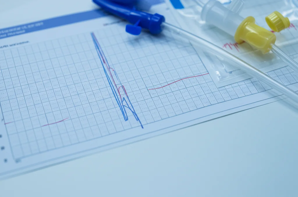 Dettaglio macro di un grafico medico su una scrivania d'ospedale accanto a un catetere urinario sterile confezionato, obiettivo macro 100mm, alta definizione, illuminazione controllata da studio, focus preciso sul grafico che mostra protocolli standard assenti.