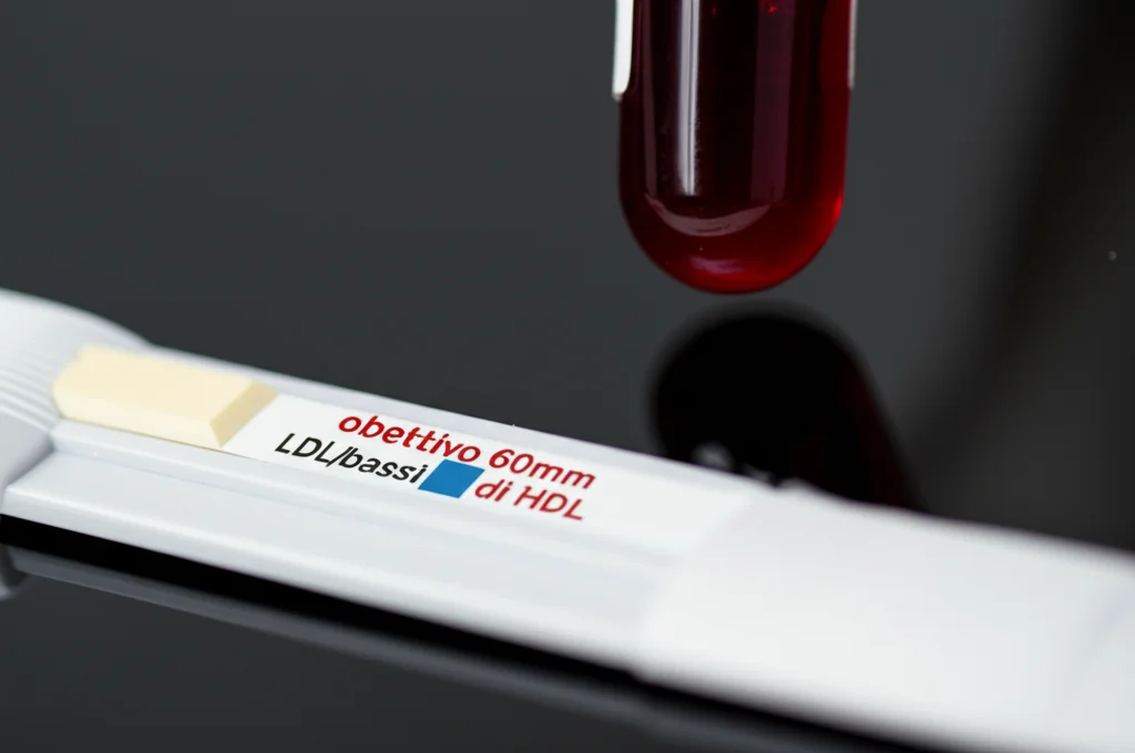Macro shot (obiettivo 60mm) di una provetta di campione di sangue accanto a una striscia reattiva per il colesterolo che mostra risultati alti di LDL/bassi di HDL, illuminazione controllata, alto dettaglio.