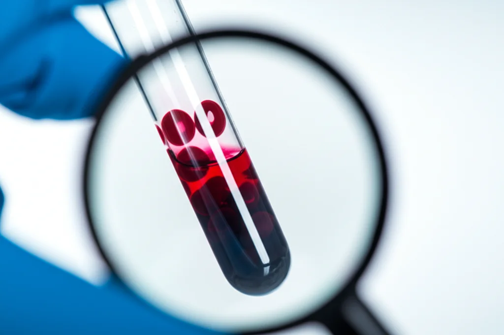 Analisi del sangue in laboratorio, primo piano di una provetta con campione di sangue separato in plasma e globuli rossi, lente macro 90mm, illuminazione controllata da laboratorio, alta definizione, messa a fuoco precisa sui componenti del sangue.