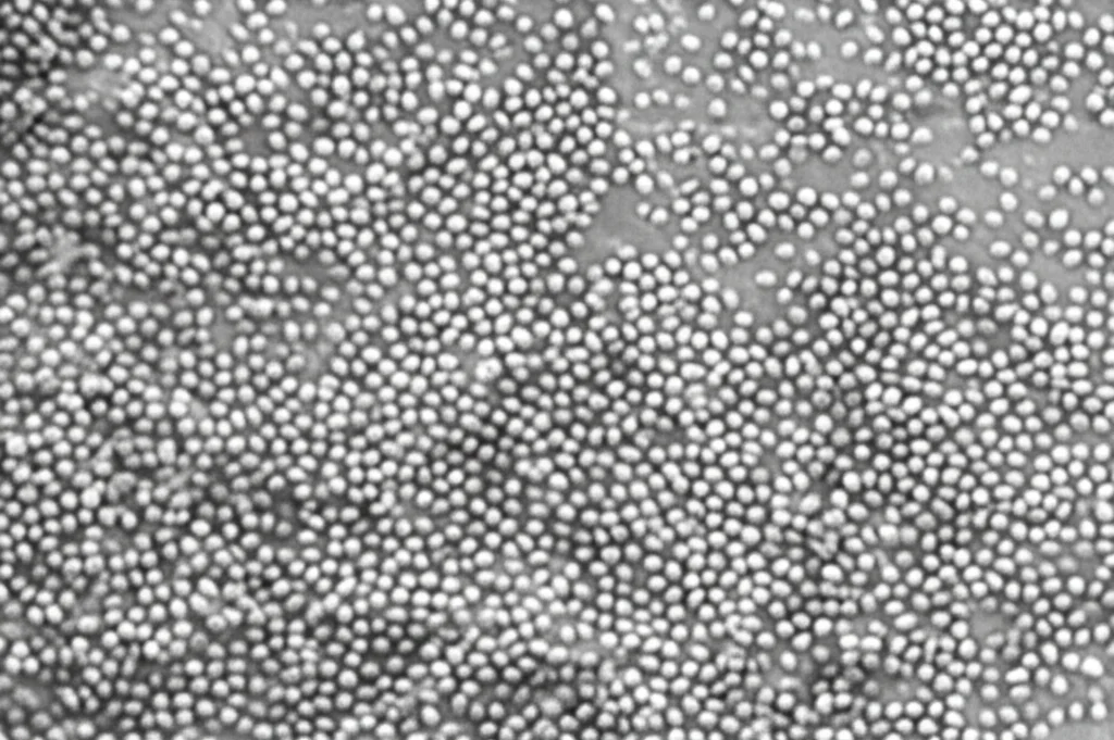 Fotografia macro di cellule T (linfociti) visualizzate al microscopio elettronico, obiettivo macro 105mm, alta definizione, illuminazione da laboratorio controllata, focus preciso sulle strutture cellulari, bianco e nero per enfatizzare i dettagli morfologici.