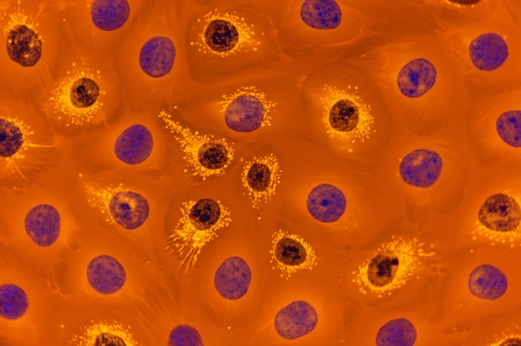 Visualizzazione microscopica ad alta definizione di cellule CAR T che interagiscono con cellule tumorali del mieloma multiplo in una piastra di Petri, illuminazione controllata, lente macro 100mm, high detail.