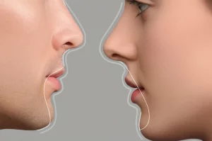 Immagine composita che mostra diverse versioni del profilo di un volto, maschile e femminile, con sottili alterazioni digitali evidenziate nella regione del mento (sinfisi mandibolare). Fotografia stile ritratto, obiettivo 35mm, focus nitido sul profilo, sfondo neutro per enfatizzare le variazioni estetiche.