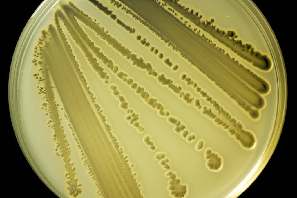 Immagine macro ad alta definizione di una coltura batterica di Mycobacterium tuberculosis su terreno Lowenstein-Jensen in una piastra di Petri, illuminazione controllata da laboratorio, obiettivo macro 100mm, messa a fuoco precisa sui dettagli delle colonie batteriche.