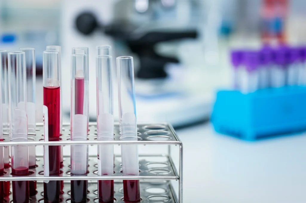 Primo piano di una provetta di sangue in un rack da laboratorio, con sfondo sfocato di attrezzature scientifiche. Luce da laboratorio brillante ma controllata, focus preciso sulla provetta, lente macro 60mm, alta definizione.