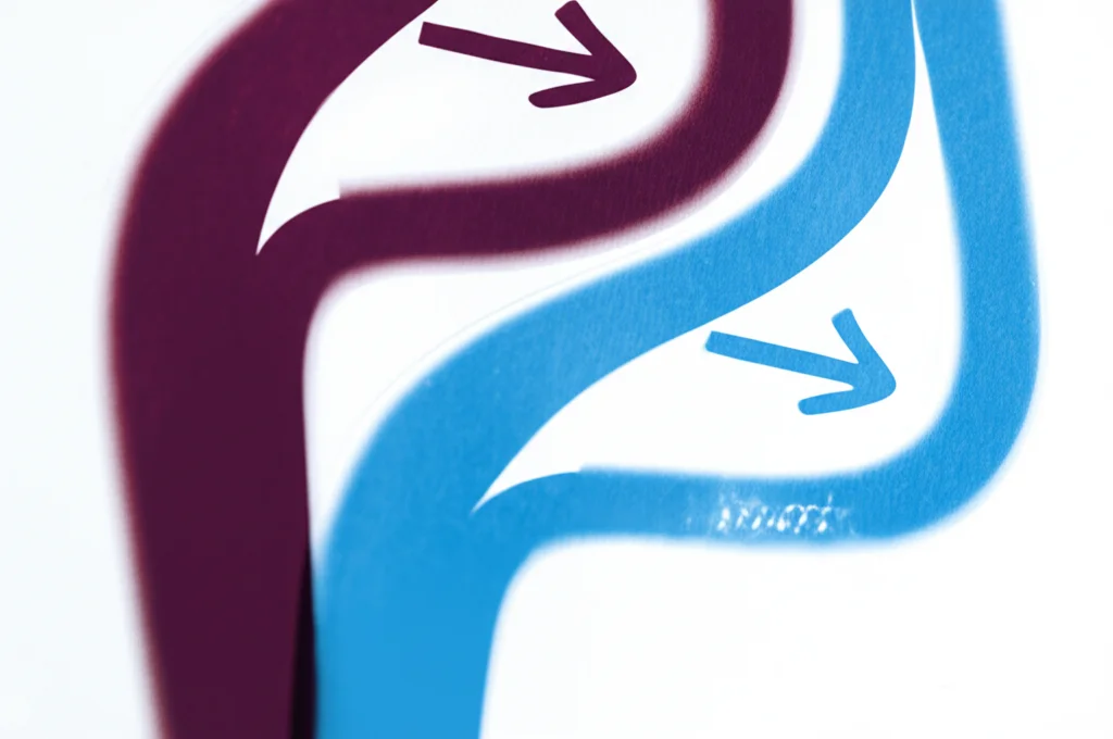 Illustrazione concettuale astratta che mostra due percorsi divergenti per i pazienti. Un percorso (rosso scuro, complesso) rappresenta il fenotipo ad alta lattilazione con esiti peggiori, l'altro (blu chiaro, più lineare) rappresenta il fenotipo a bassa lattilazione. Depth of field, duotone rosso e blu, visualizzazione astratta degli outcome clinici basati sui fenotipi.