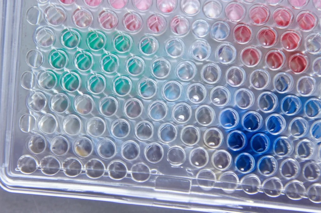 Fotografia macro ad alta definizione di una piastra ELISA utilizzata per l'analisi dei biomarcatori nel plasma sanguigno. Obiettivo macro 100mm, illuminazione da laboratorio controllata e precisa, focus sui pozzetti colorati che indicano la presenza e la concentrazione dei biomarcatori.