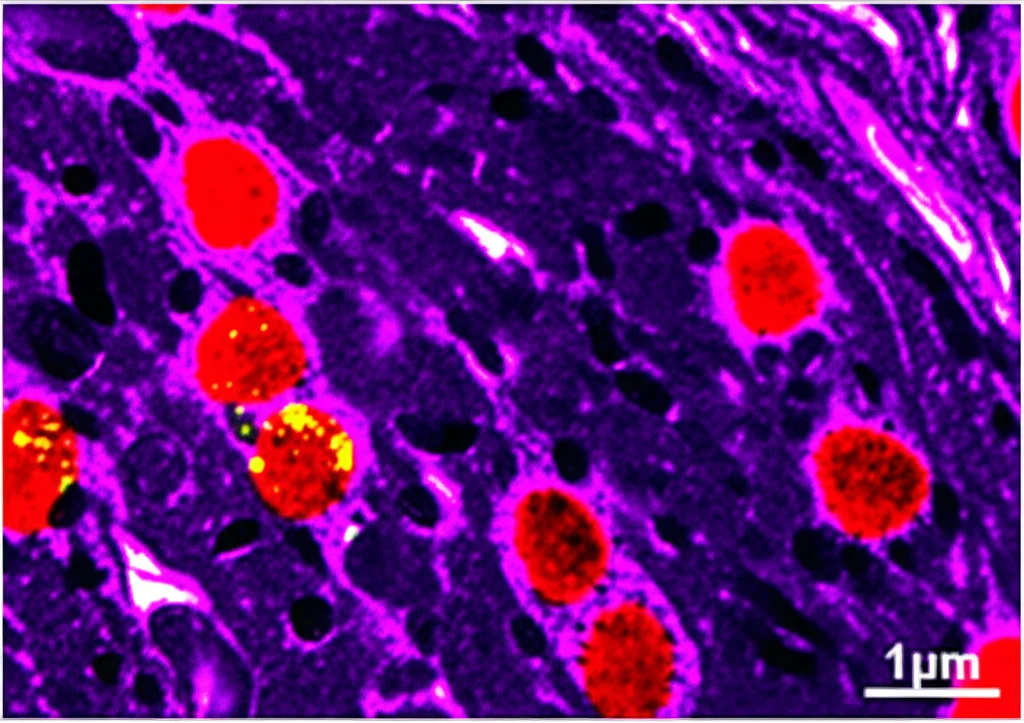 Microscopia confocale fotorealistica di una sezione di organoide cerebrale vascolarizzato (FVCors) dopo esposizione a ipossia. Cellule neurali progenitrici (PAX6+) debolmente illuminate in blu DAPI, cellule progenitrici intermedie (TBR2+) marcate in rosso vivo, vicine a strutture simili a vasi sanguigni marcate in verde (GFP+). Evidenza di segnali di fosforilazione SMAD (punti luminosi gialli) più intensi vicino ai vasi. Lente ad alta magnificazione, illuminazione da microscopia, alta definizione.