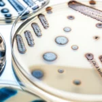 Immagine fotorealistica macro con obiettivo da 85mm, primo piano di diversi dischi per test di antibiotico-resistenza su una piastra di agar Petri con crescita batterica. Si vedono chiaramente zone di inibizione (dove l'antibiotico funziona) e zone di crescita batterica fino al disco (resistenza). Alta definizione, messa a fuoco precisa, illuminazione controllata da laboratorio scientifico sullo sfondo.