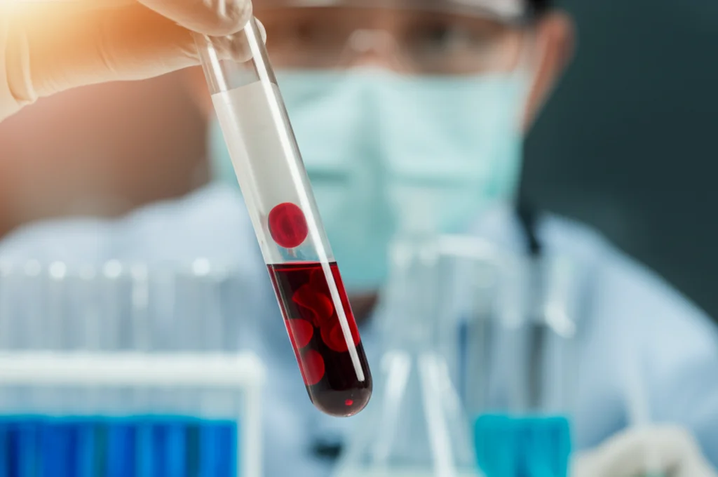 Primo piano di una provetta di sangue in un laboratorio di ricerca medica, luce controllata, obiettivo macro 90mm, alta definizione dei globuli rossi visibili, sfondo leggermente sfocato con attrezzatura scientifica.
