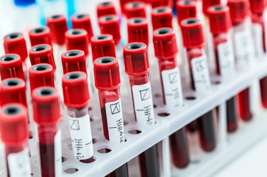 Scatto macro fotorealistico in un laboratorio medico che mostra provette di sangue in fase di analisi per parametri biochimici come il TSH e l'HbA1c. Obiettivo macro 100mm, alta definizione, focus preciso, illuminazione controllata che evidenzia le etichette e i liquidi.