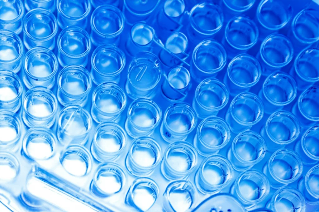 Fotografia macro di una piastra ELISA a 96 pozzetti utilizzata in laboratorio per la diagnosi sierologica, illuminazione controllata, alta definizione, lente macro 100mm, focus preciso sui pozzetti con reazione colorimetrica blu più o meno intensa visibile.