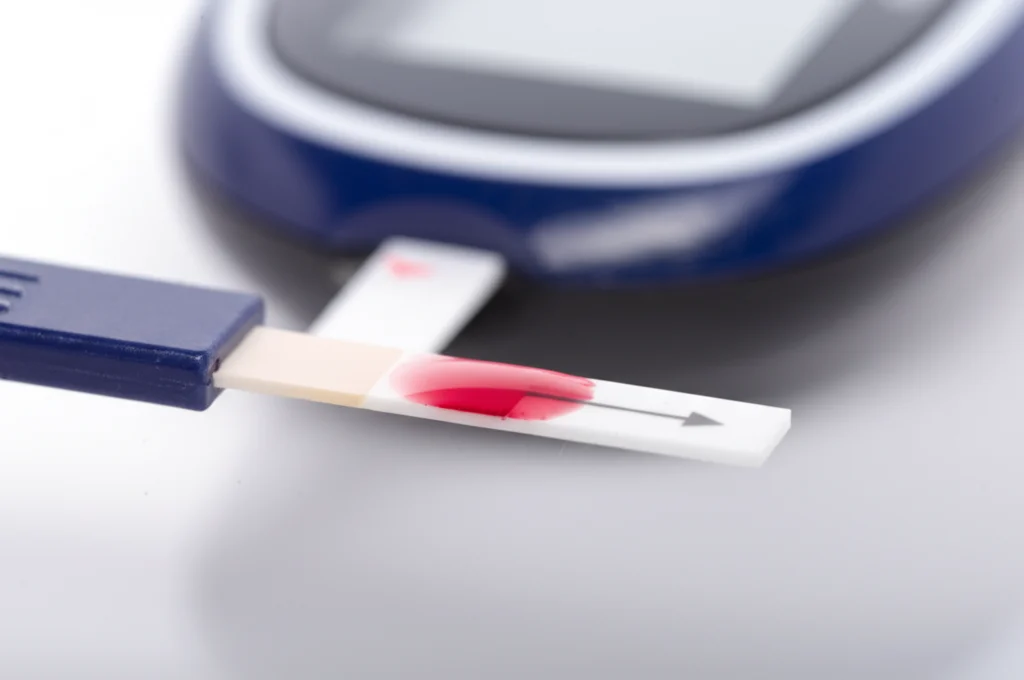 Primo piano macro di una goccia di sangue su una striscia reattiva per la glicemia, con un glucometro sfocato sullo sfondo. Illuminazione controllata, alta definizione, lente macro 100mm, per illustrare il monitoraggio della glicemia e l'HbA1c come base per il calcolo dell'SHR.