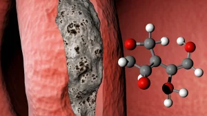 Immagine macrofotografica ad alta definizione di un'arteria carotide umana parzialmente ostruita da placca aterosclerotica, con accanto una rappresentazione stilizzata di molecole di resveratrolo. Obiettivo macro 105mm, illuminazione laterale controllata per enfatizzare la texture della placca, alta definizione, messa a fuoco selettiva sulla placca.