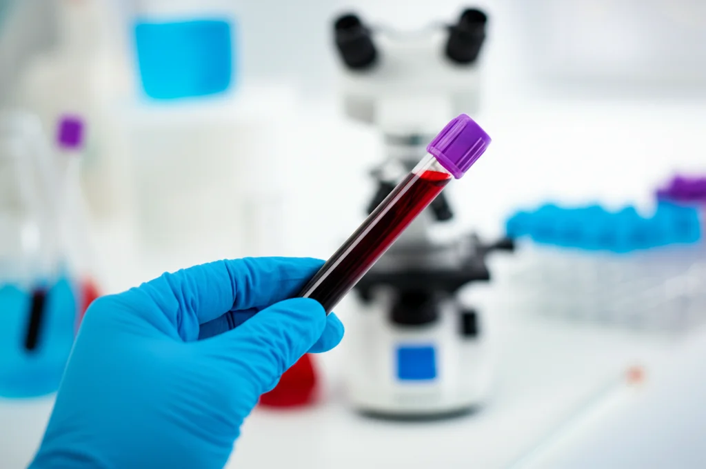 Fotografia macro di una provetta di sangue tenuta da una mano guantata in un laboratorio medico. Messa a fuoco precisa sulla provetta, sfondo sfocato con strumentazione da laboratorio. Obiettivo macro 100mm, illuminazione controllata, alta definizione.