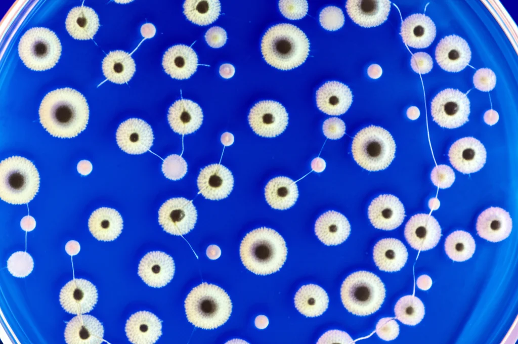 Fotografia macro ad alta definizione di una piastra di Petri con colonie di cellule tumorali sotto un microscopio in un laboratorio di ricerca sul cancro. L'illuminazione è controllata per evidenziare i dettagli cellulari. Obiettivo macro 100mm, messa a fuoco precisa sulle cellule, alta risoluzione.