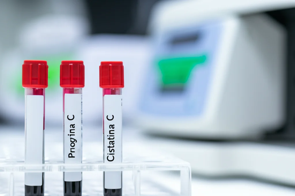 Fotografia macro di provette contenenti campioni di sangue in un rack all'interno di un analizzatore di laboratorio high-tech. Focus nitido su una provetta etichettata 'Cistatina C'. Illuminazione da laboratorio precisa e controllata, obiettivo macro 100mm, alta definizione dei dettagli delle provette e dell'etichetta, sfondo sfocato con altre attrezzature scientifiche.