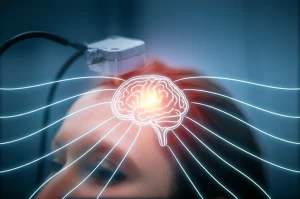 Fotografia macro di un trasduttore a ultrasuoni focalizzati (tFUS) posizionato delicatamente vicino alla tempia di una persona, con una sovrapposizione grafica stilizzata e traslucida del cervello umano che mostra onde sonore convergenti sull'amigdala, evidenziata da un bagliore. Luce da studio controllata per enfatizzare i dettagli del trasduttore e la texture della pelle, obiettivo macro 85mm, alta definizione, profondità di campo ridotta per mantenere il focus sul punto di applicazione.