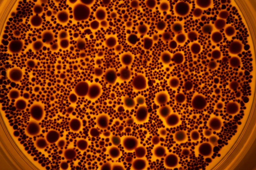 Immagine macro di cellule staminali in una piastra di Petri sotto una luce da laboratorio, obiettivo macro 90mm, alta definizione, illuminazione controllata e focalizzata, simboleggiante la ricerca avanzata sulla terapia ponte per MDS e CMML.