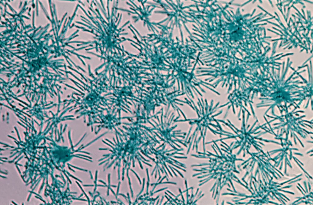 Macro fotografia, lente 90mm, di cellule staminali mesenchimali del legamento parodontale umano (hPDL-MSCs) in coltura su una piastra Petri, evidenziando la loro forma fusiforme caratteristica. Alta definizione, messa a fuoco precisa, illuminazione controllata da laboratorio.