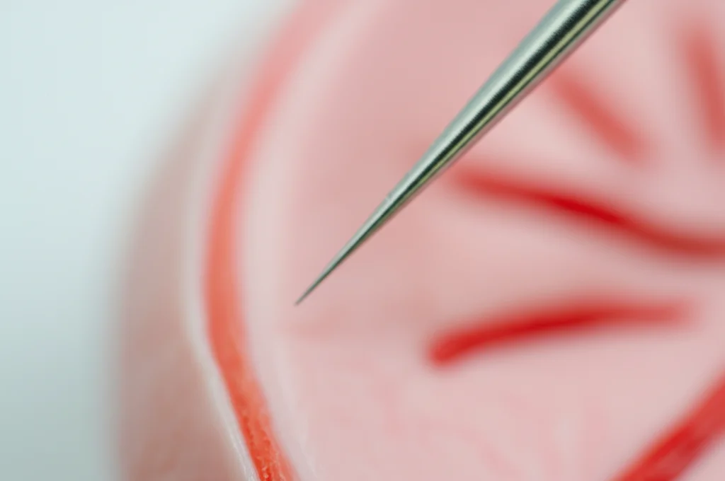 Primo piano macro fotorealistico di un ago sottile che preleva un campione da un modello di linfonodo cervicale per un esame FNAC/FNA-Tg. Illuminazione da laboratorio controllata, alta definizione dei dettagli dell'ago e del tessuto modello. Lente macro 90mm, messa a fuoco precisa sulla punta dell'ago.