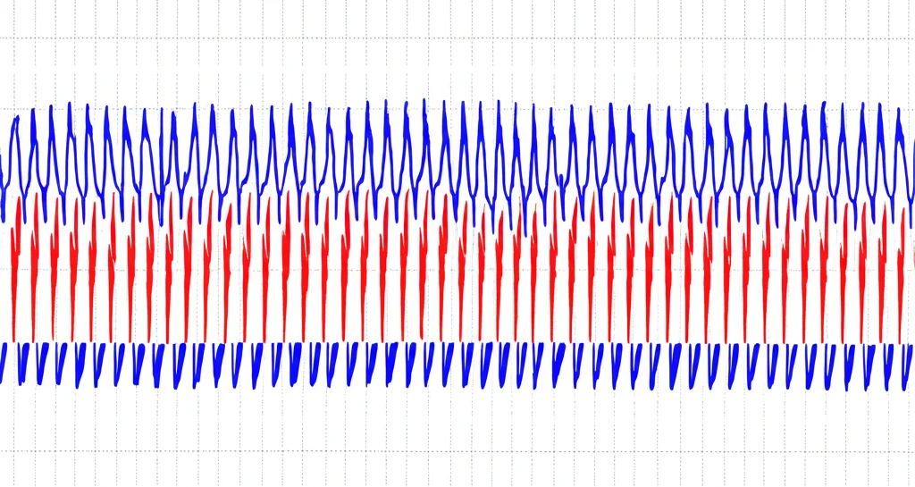 Visualizzazione scientifica fotorealistica di segnali elettrofisiologici (potenziali d'azione) simili a picchi nitidi su uno sfondo scuro, che simboleggiano la registrazione neurale a basso rumore. Alta definizione.