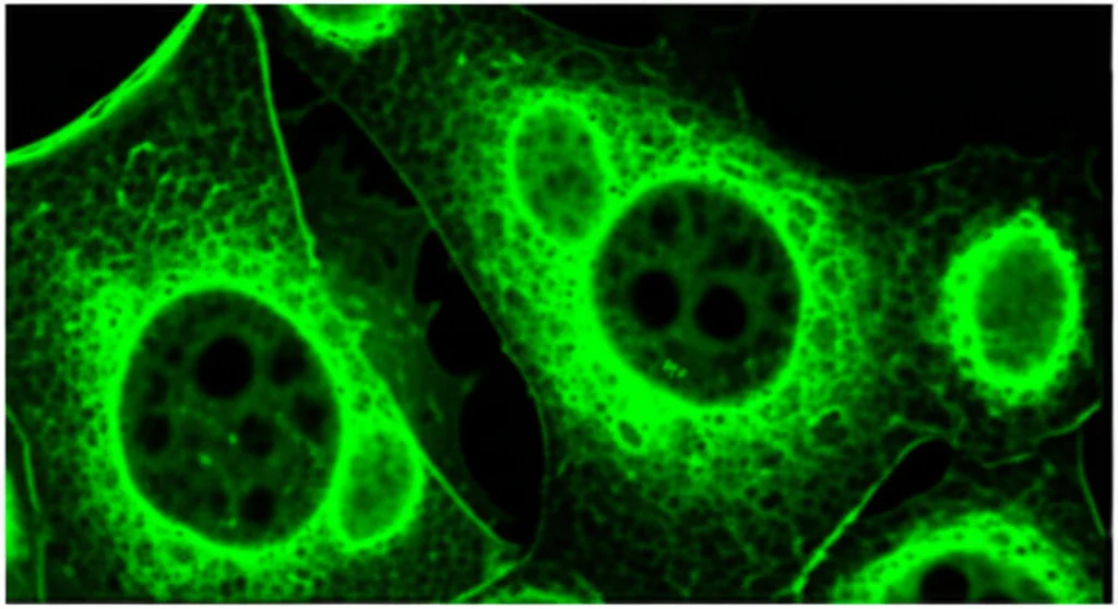 Stile immagine di microscopia, dettagli elevati, messa a fuoco precisa, che mostrano macrofagi (cellule RAW 264.7) trattati con lattato e LPS. Concentrarsi sul citoplasma che mostra l'accumulo di proteina HMGB1 (visualizzata forse con immunofluorescenza, verde brillante) e evidenza di rilascio di esosoma (piccole vescicole in erba dalla membrana cellulare). Un sottile effetto di overlay potrebbe suggerire il processo chimico di lattilazione che si verifica su HMGB1.